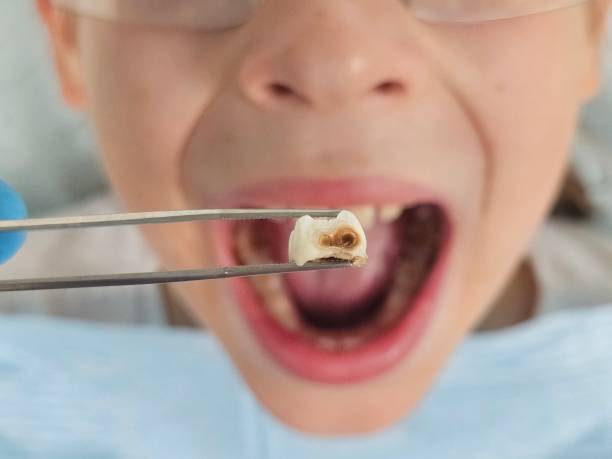 Best Emergency Dental Services for Seniors in Sansom Park, TX