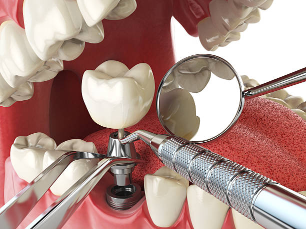 Best Mobile Emergency Dentist in Sansom Park, TX