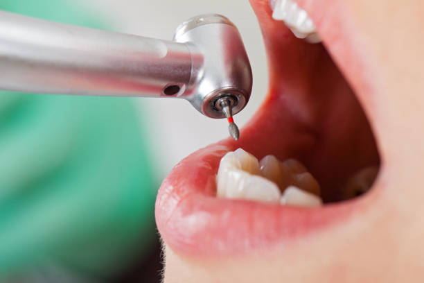 Best Urgent Dental Care for Toothache in Sansom Park, TX